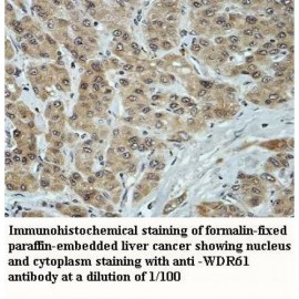 WDR61 Antibody
