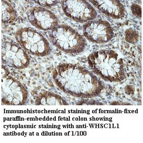 WHSC1L1 Antibody