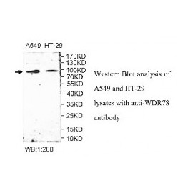 WDR31 Antibody