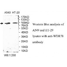WDR31 Antibody