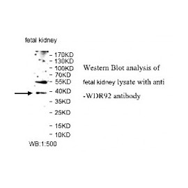 WDR65 Antibody