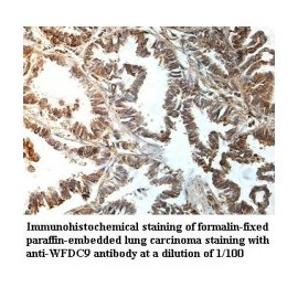 WDR65 Antibody