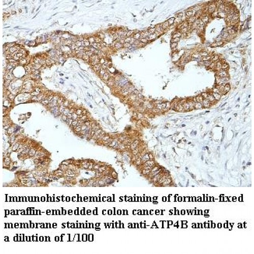 ATP4B Antibody