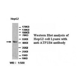 PPM1G Antibody