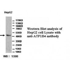 PPM1G Antibody