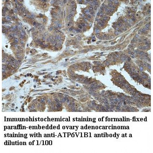 ATP6V1B1 Antibody