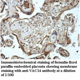 VAC14 Antibody