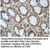 ATP6V0A2 Antibody