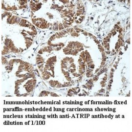ATRIP Antibody