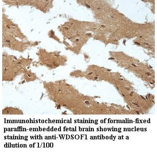 WDSOF1 Antibody