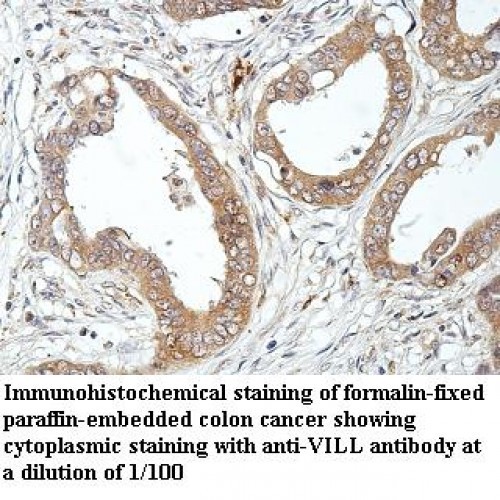 VILL Antibody