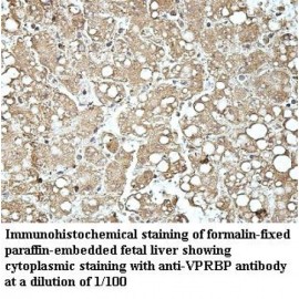 VPRBP Antibody