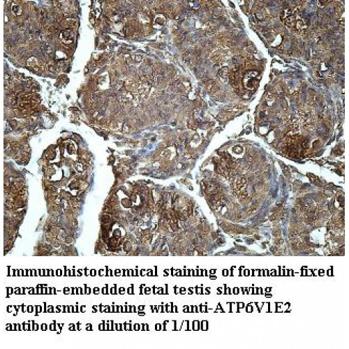 ATP6V1E2 Antibody
