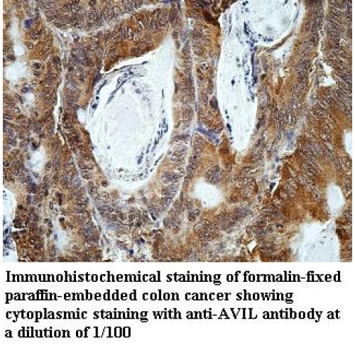 AVIL Antibody