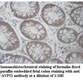 AVPI1 Antibody