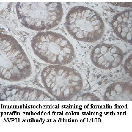AVPI1 Antibody