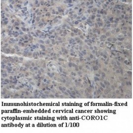 CORO1C Antibody