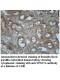 VPS37A Antibody