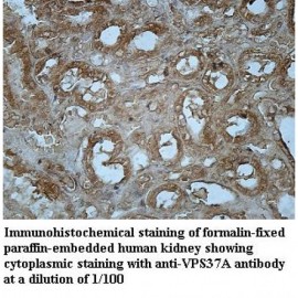 VPS37A Antibody