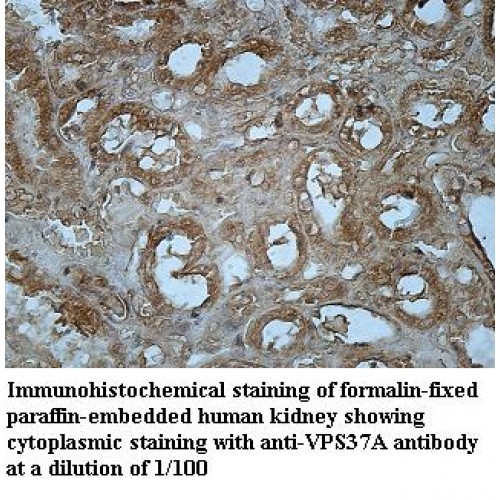 VPS37A Antibody