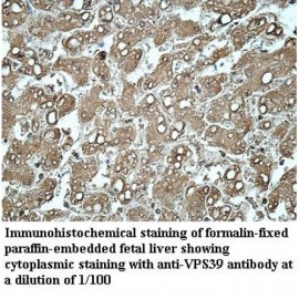 VPS39 Antibody