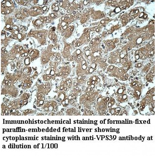 VPS39 Antibody