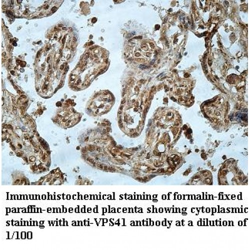 VPS41 Antibody