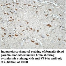 VPS4A Antibody