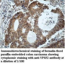 VPS52 Antibody