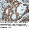 VPS52 Antibody