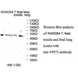 VPS72 Antibody