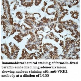 VRK1 Antibody