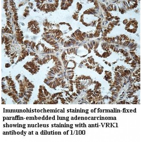 VRK1 Antibody