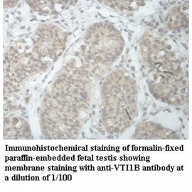 VTI1B Antibody
