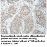 VTI1B Antibody