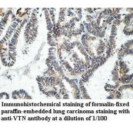 VTN Antibody