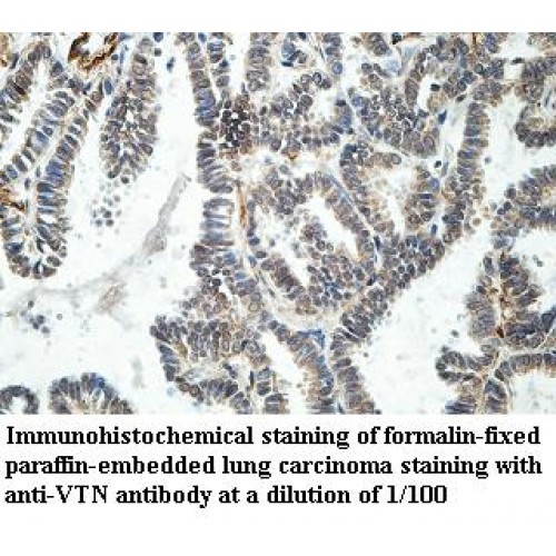 VTN Antibody