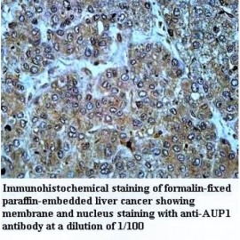 AUP1 Antibody