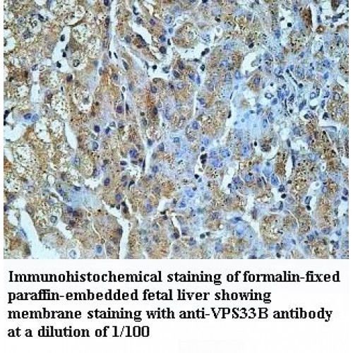 VPS33B Antibody