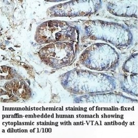 VTA1 Antibody