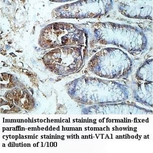 VTA1 Antibody