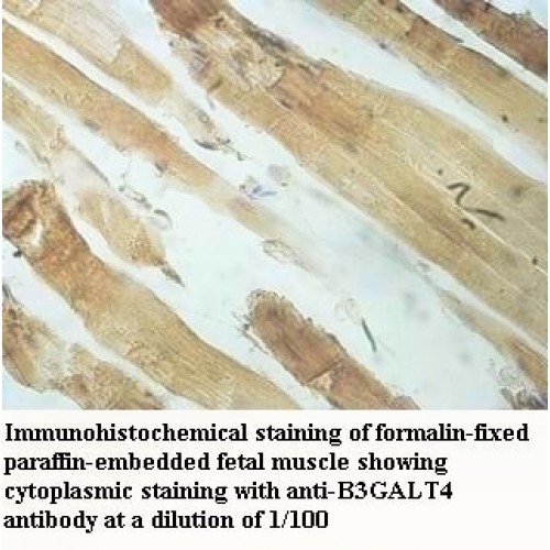 B3GALT4 Antibody