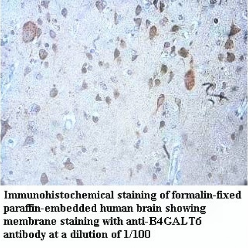 B4GALT6 Antibody