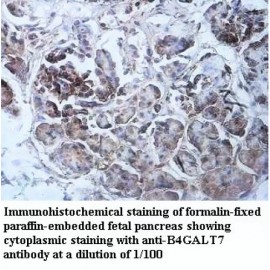 B4GALT7 Antibody