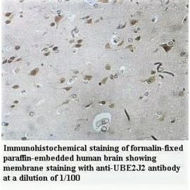 UBE2J2 Antibody