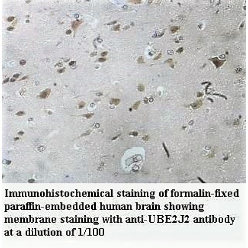 UBE2J2 Antibody