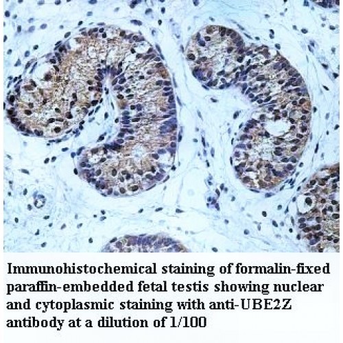 UBE2Z Antibody