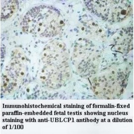 UBLCP1 Antibody