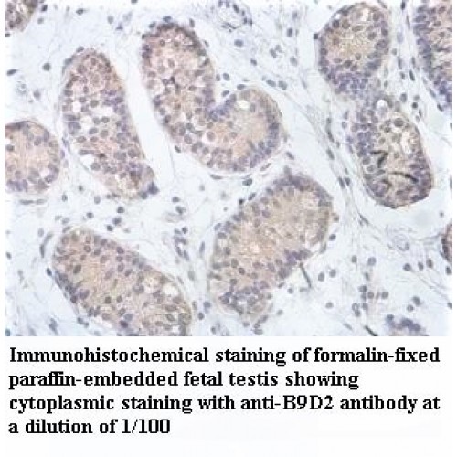 B9D2 Antibody