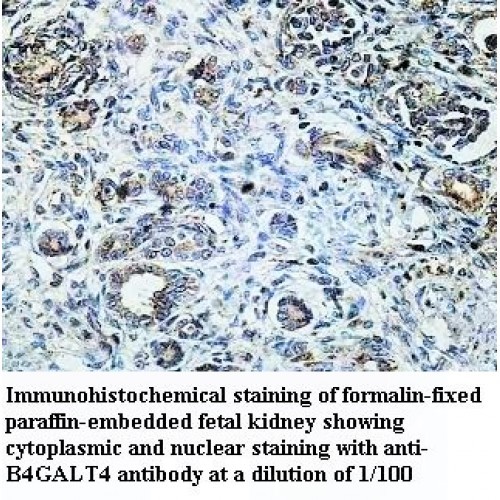 B4GALT4 Antibody